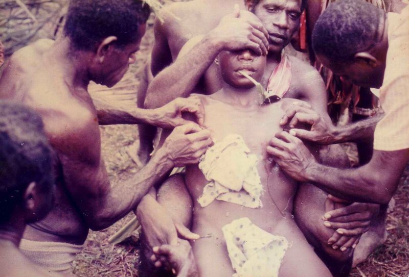 Traditional Scarification by Tribes